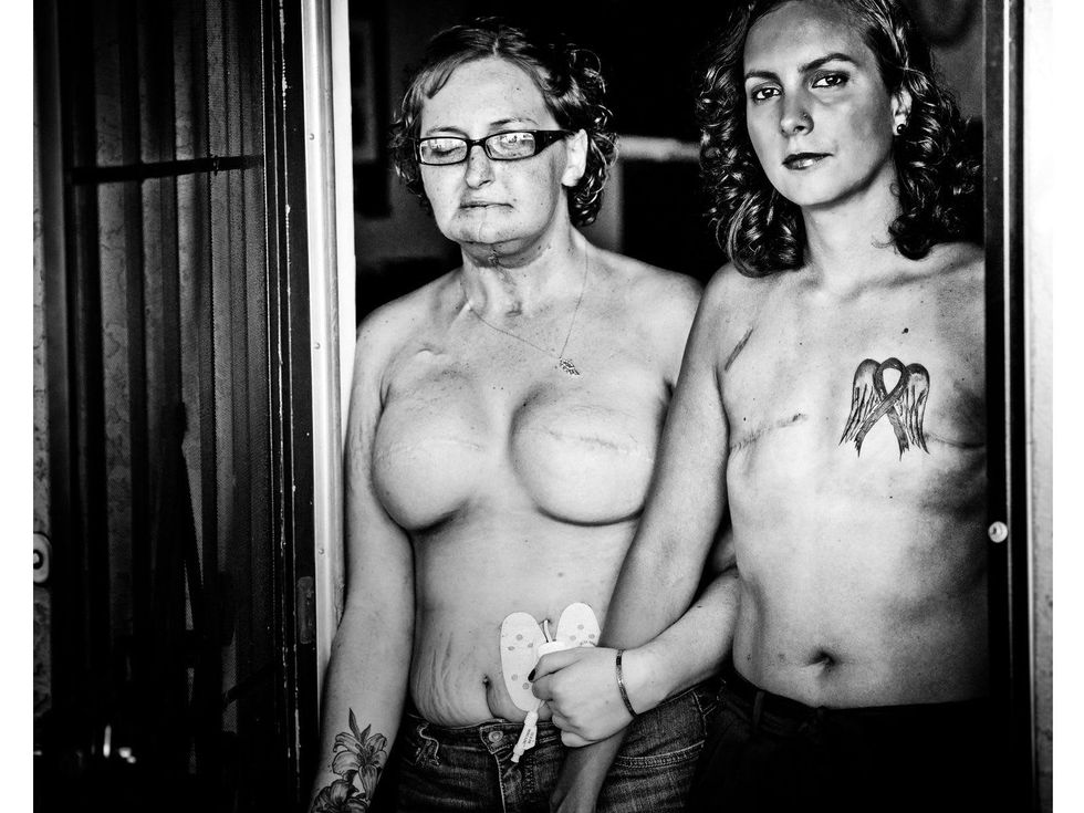 10 The Scar Project breast cancer by David Jay October 2013 Jolene and Candice
