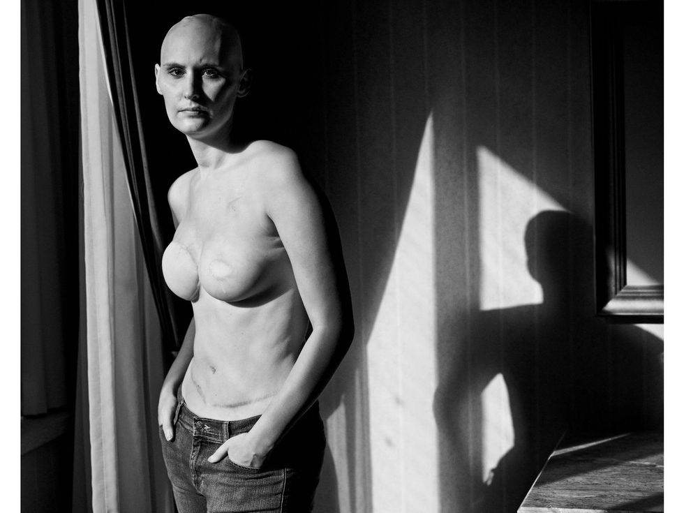 15 The Scar Project breast cancer by David Jay October 2013 sjkfjtbn