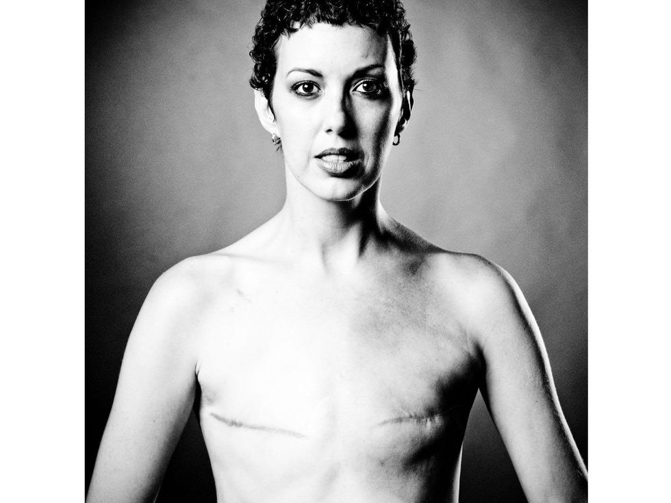 2 The Scar Project breast cancer by David Jay October 2013 092b-Edit
