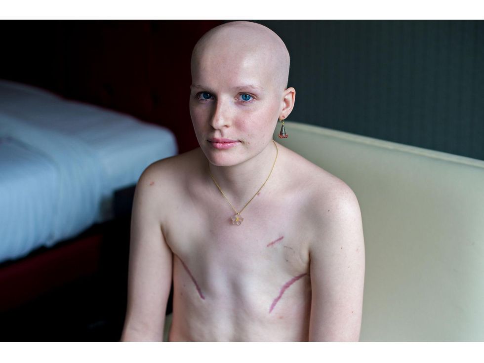 3 The Scar Project breast cancer by David Jay October 2013 DSC_3431-Edit