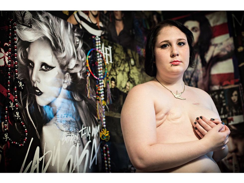 5 The Scar Project breast cancer by David Jay October 2013 DSC_9716