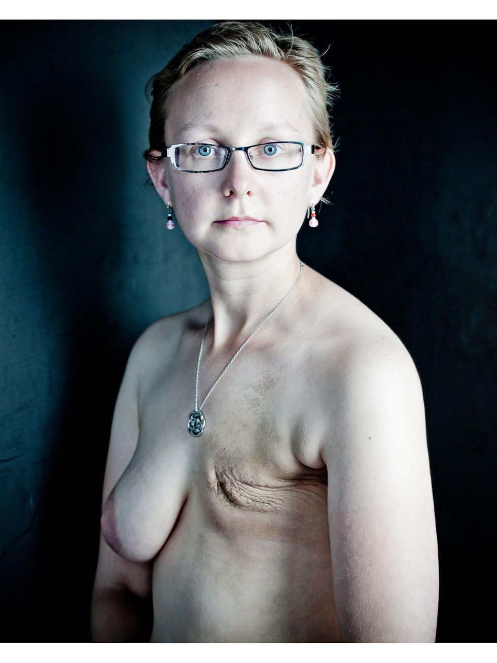 6 The Scar Project breast cancer by David Jay October 2013 ghfghfh