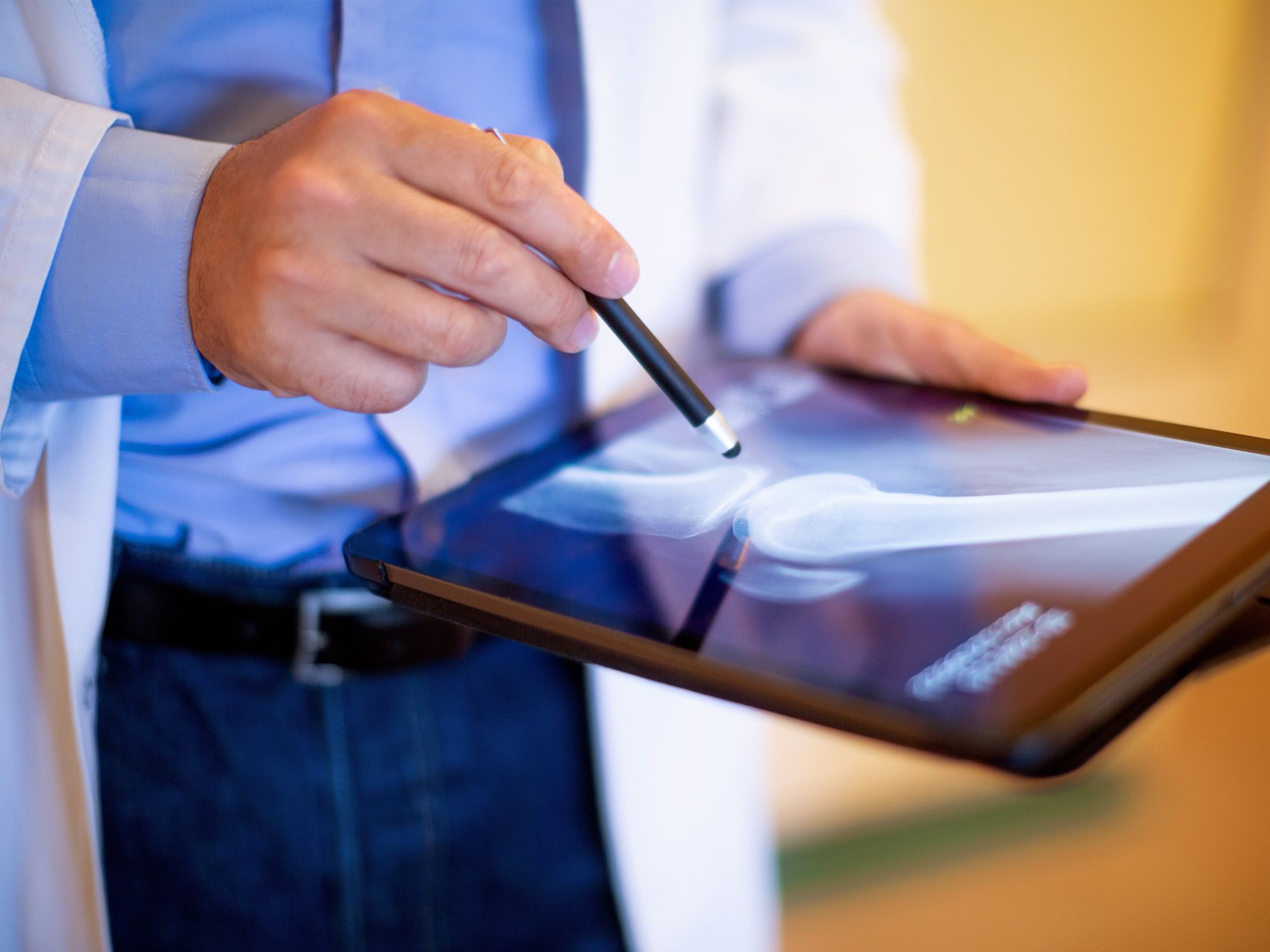 Doctor looking at X-ray.