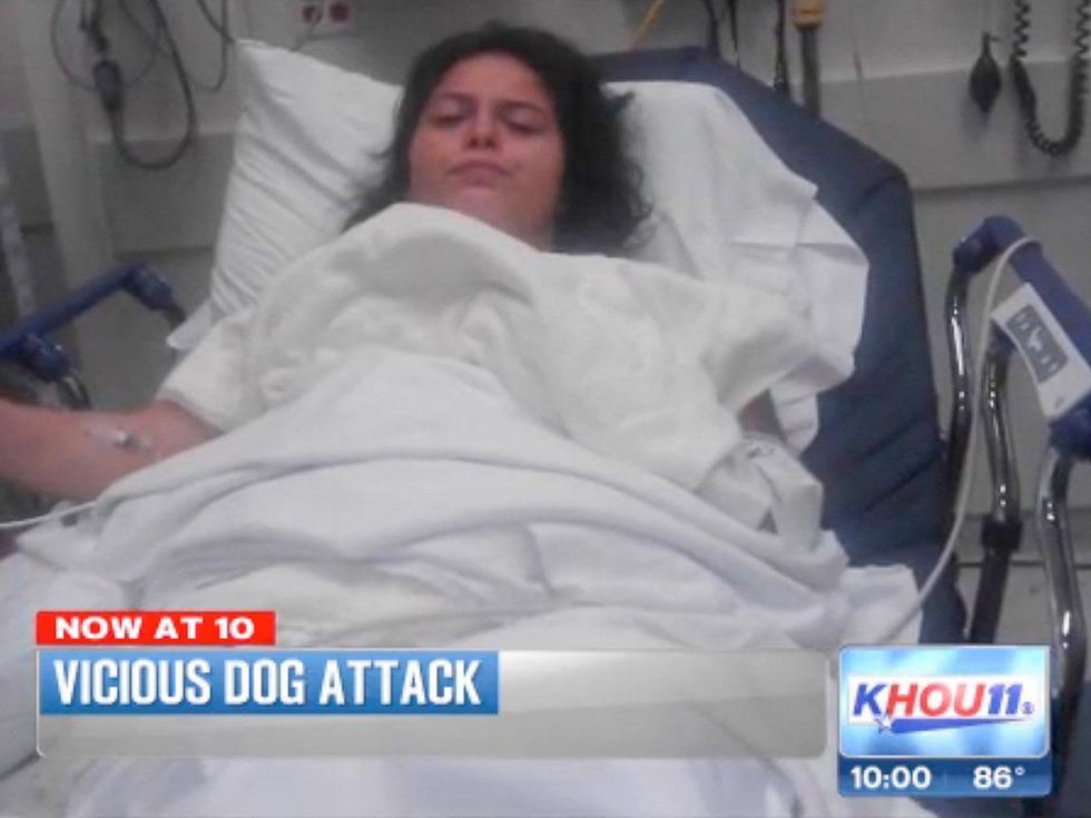 girl attacked by pit bull dogs July 2013 RUN FLAT