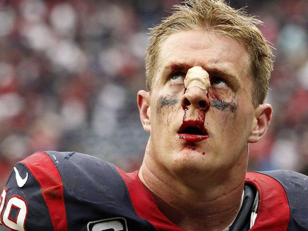 J.J. Watt Houston Texans bloody nose after loss to Seahawks September 2013