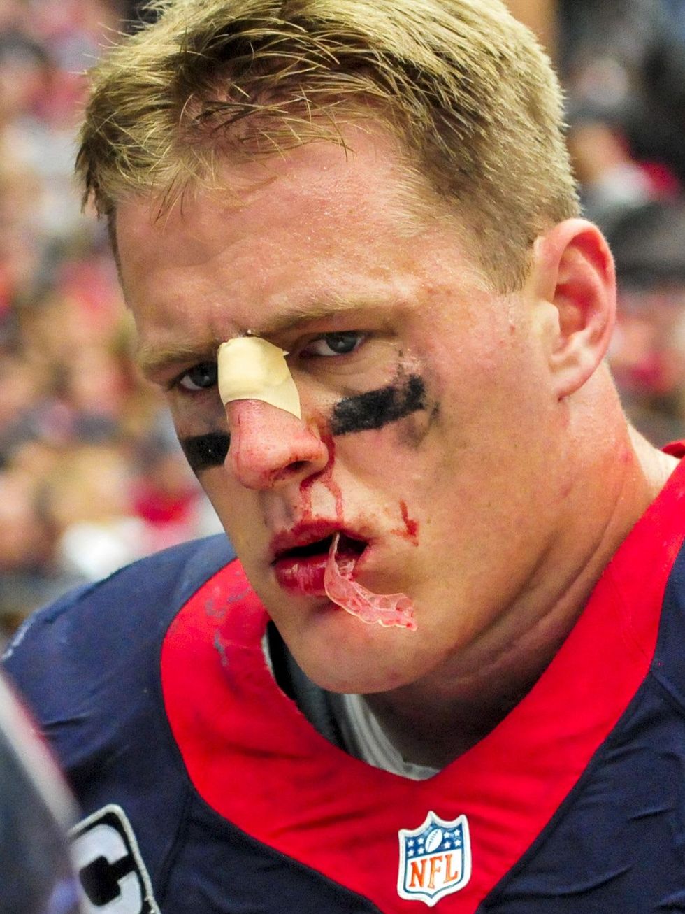 J.J. Watt nose