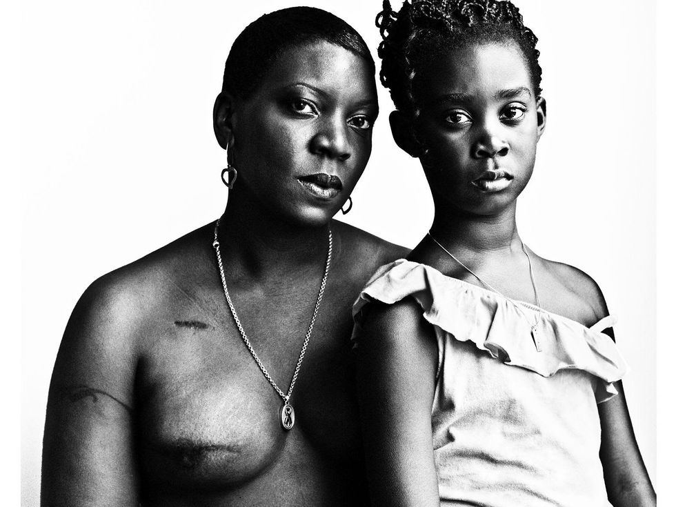 The Scar Project breast cancer by David Jay October 2013 African-American